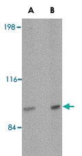 Anti-SATB2 Rabbit Polyclonal Antibody