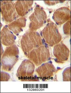 Anti-CLMP Rabbit Polyclonal Antibody (AP (Alkaline Phosphatase))