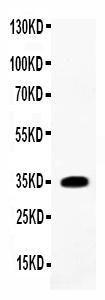 Anti-IL-1 beta Polyclonal Antibody