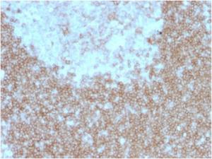 Immunohistochemical analysis of formalin-fixed, paraffin-embedded human tonsil using Anti-BAFF-R Antibody [BAFFR/1557]