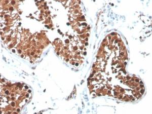 Anti-Inhibin alpha antibody