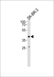 Anti-ELK3 Rabbit Polyclonal Antibody (APC (Allophycocyanin))