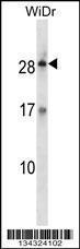 Anti-KLK12 Rabbit Polyclonal Antibody (APC (Allophycocyanin))