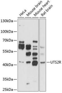 Western blot analysis of extracts of various cell lines, using Anti-GPCR GPR14 Antibody (A11588) at 1:1,000 dilution