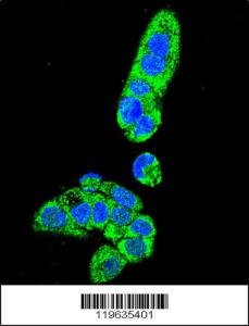 Anti-FAH Rabbit Polyclonal Antibody (FITC (Fluorescein Isothiocyanate))