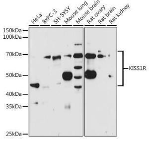 Western blot analysis of extracts of various cell lines, using Anti-GPR54 Antibody (A11590) at 1:1,000 dilution