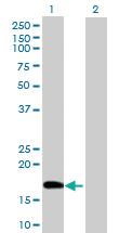 Anti-POLE3 Mouse Polyclonal Antibody