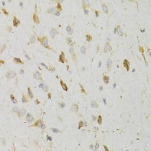 Immunohistochemistry analysis of paraffin-embedded rat brain using Anti-GPR54 Antibody (A11590) at a dilution of 1:100 (40X lens). Perform microwave antigen retrieval with 10 mM PBS buffer pH 7.2 before commencing with IHC staining protocol