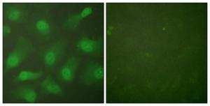 Anti-Cellular Apoptosis Susceptibility Rabbit Polyclonal Antibody