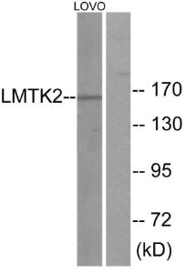 Western blot analysis of lysates from LOVO cells using Anti-LMTK2 Antibody. The right hand lane represents a negative control, where the antibody is blocked by the immunising peptide