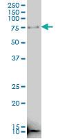 Anti-MARCH10 Mouse Monoclonal Antibody [clone: 5E10]