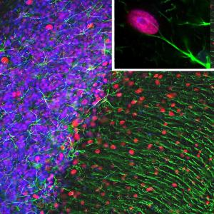 Immunofluorescent analysis of a rat cerebellum section stained with Anti-GFAP Antibody (A85419), at a dilution of 1:5,000, in green, and co-stained with Anti-MeCP2 Antibody (A104324), at a dilution of 1:500, in red. The nuclear DNA is visualised in blue using Hoechst staining.