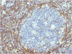 Immunohistochemical analysis of formalin-fixed, paraffin-embedded human tonsil using Anti-Bcl-2 Antibody [BCL2/782]