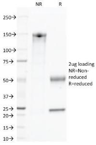 SDS-PAGE analysis of Anti-CD45 Antibody [135-4C5] under non-reduced and reduced conditions; showing intact IgG and intact heavy and light chains, respectively. SDS-PAGE analysis confirms the integrity and purity of the antibody