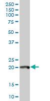 Anti-POLE3 Mouse Polyclonal Antibody