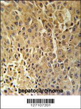 Anti-DHB13 Rabbit Polyclonal Antibody (Biotin)