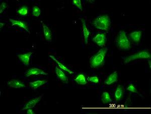 Anti-CPVL Mouse Monoclonal Antibody [clone: 2G5-1C1]