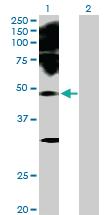 Anti-PAX2 Rabbit Polyclonal Antibody