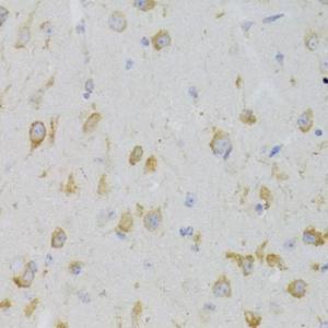 Immunohistochemistry analysis of paraffin-embedded mouse brain using Anti-GPR54 Antibody (A11590) at a dilution of 1:100 (40X lens). Perform microwave antigen retrieval with 10 mM PBS buffer pH 7.2 before commencing with IHC staining protocol