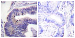 Anti-PDE4D Rabbit Polyclonal Antibody