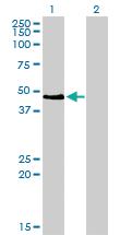 Anti-PAX2 Mouse Monoclonal Antibody [clone: 3C7]