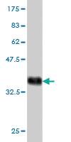 Anti-TIMM9 Mouse Monoclonal Antibody [clone: 1D6]