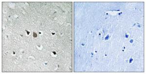 Immunohistochemical analysis of paraffin-embedded human brain tissue using Anti-C-RAF Antibody The right hand panel represents a negative control, where the antibody was pre-incubated with the immunising peptide