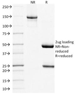 SDS-PAGE analysis of Anti-BAFF-R Antibody [BAFFR/1557] under non-reduced and reduced conditions; showing intact IgG and intact heavy and light chains, respectively. SDS-PAGE analysis confirms the integrity and purity of the antibody.