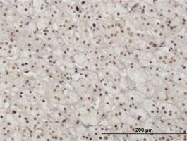 Anti-PAX2 Mouse Monoclonal Antibody [clone: 3C7]