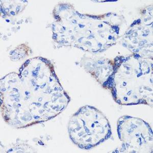 Immunohistochemistry analysis of paraffin-embedded human placenta using Anti-Kisspeptin Antibody (A11594) at a dilution of 1:200 (40x lens)