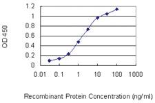 Anti-PAX2 Mouse Monoclonal Antibody [clone: 3C7]