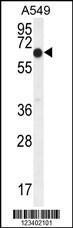 Anti-ELL Rabbit Polyclonal Antibody (FITC (Fluorescein Isothiocyanate))