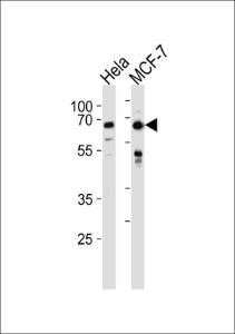 Anti-FOXO3 Rabbit Polyclonal Antibody (APC (Allophycocyanin))