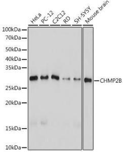 Western blot analysis of extracts of various cell lines, using Anti-CHMP2B Antibody [ARC2404] (A306419) at 1:1,000 dilution