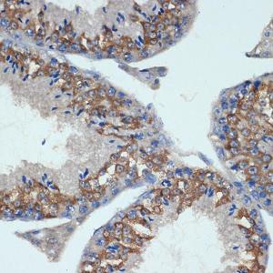 Immunohistochemistry analysis of paraffin-embedded mouse testis using Anti-CHMP2B Antibody [ARC2404] (A306419) at a dilution of 1:100 (40X lens). Perform microwave antigen retrieval with 10 mM Tris/EDTA buffer pH 9.0 before commencing with IHC staining protocol