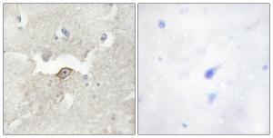 Immunohistochemical analysis of paraffin-embedded human brain tissue using Anti-LMTK2 Antibody. The right hand panel represents a negative control, where the antibody was pre-incubated with the immunising peptide