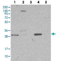 Anti-NIT2 Rabbit Polyclonal Antibody