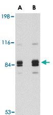 Anti-SNPH Rabbit Polyclonal Antibody