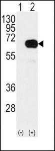 Anti-SMAD4 Rabbit Polyclonal Antibody (AP (Alkaline Phosphatase))