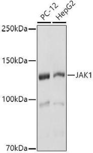 Anti-JAK1 antibody