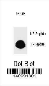 Anti-ERBB2 Rabbit Polyclonal Antibody (AP (Alkaline Phosphatase))