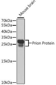 Western blot analysis of extracts of mouse brain, using Anti-Prion protein PrP Antibody (A306421) at 1:1000 dilution