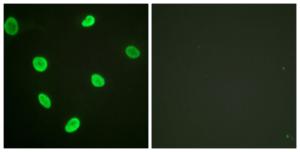 Immunofluorescence analysis of HeLa cells using Anti-Histone H2B (acetyl Lys12) Antibody. The right hand panel represents a negative control, where the Antibody was pre-incubated with the immunising peptide