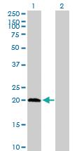 Anti-PPCDC Mouse Polyclonal Antibody