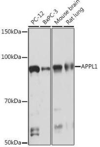 Western blot analysis of extracts of various cell lines, using Anti-APPL Antibody [ARC1356] (A306422) at 1:1,000 dilution. The secondary antibody was Goat Anti-Rabbit IgG H&L Antibody (HRP) at 1:10,000 dilution.