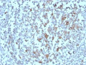 Immunohistochemical analysis of formalin-fixed, paraffin-embedded human tonsil using Anti-BAFF-R Antibody [BAFFR/1558]