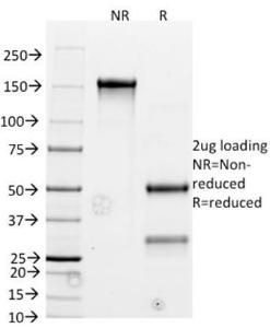 SDS-PAGE analysis of Anti-Bcl-2 Antibody [BCL2/782] under non-reduced and reduced conditions; showing intact IgG and intact heavy and light chains, respectively. SDS-PAGE analysis confirms the integrity and purity of the antibody