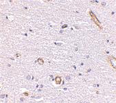 Anti-SNPH Rabbit Polyclonal Antibody