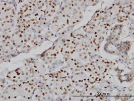 Anti-CMAS Mouse Monoclonal Antibody [clone: 5A2]