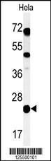 Anti-CP054 Rabbit Polyclonal Antibody (PE (Phycoerythrin))